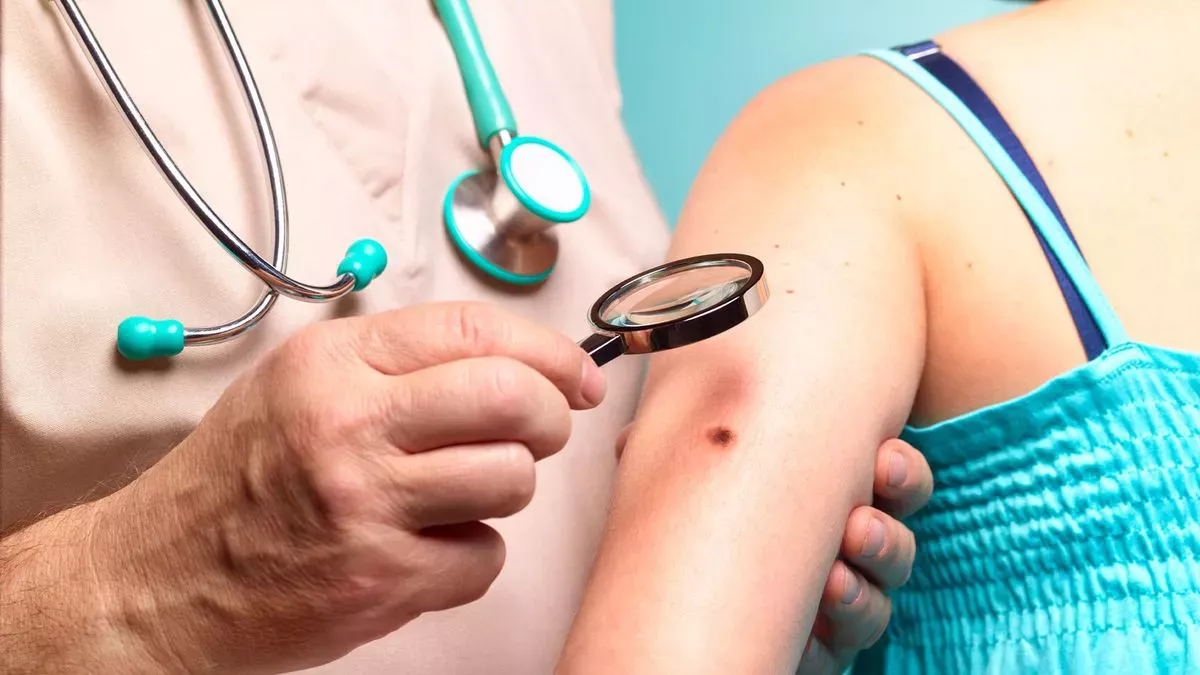 Causas, tipos, prevención y tratamiento