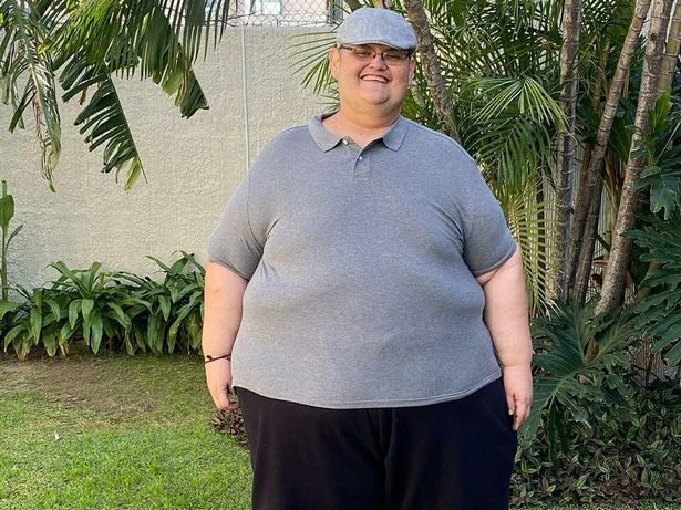 El "hombre más gordo del mundo" pierde 330 kg y revela los beneficios más sorprendentes de la transformación corporal