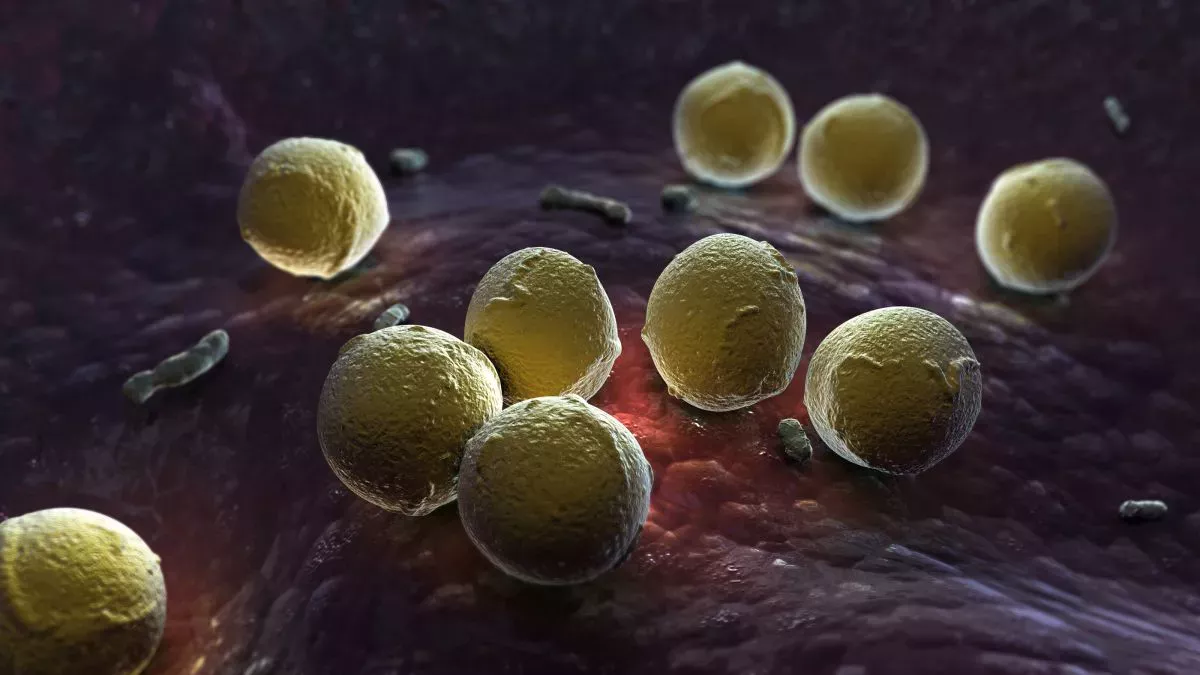 En un caso poco frecuente, un hombre desarrolla una infección bacteriana