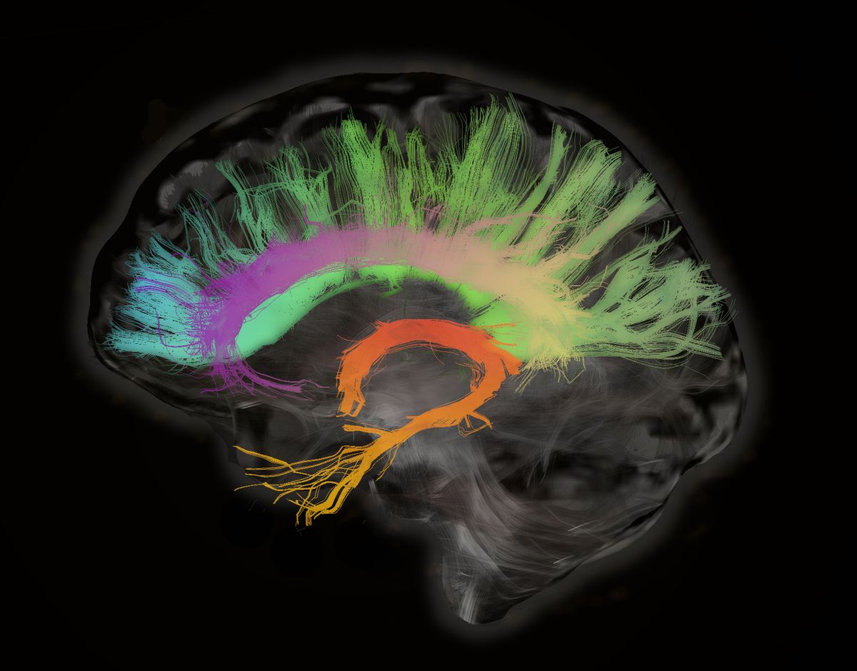 El ciclo menstrual está vinculado a cambios estructurales en todo el cerebro
