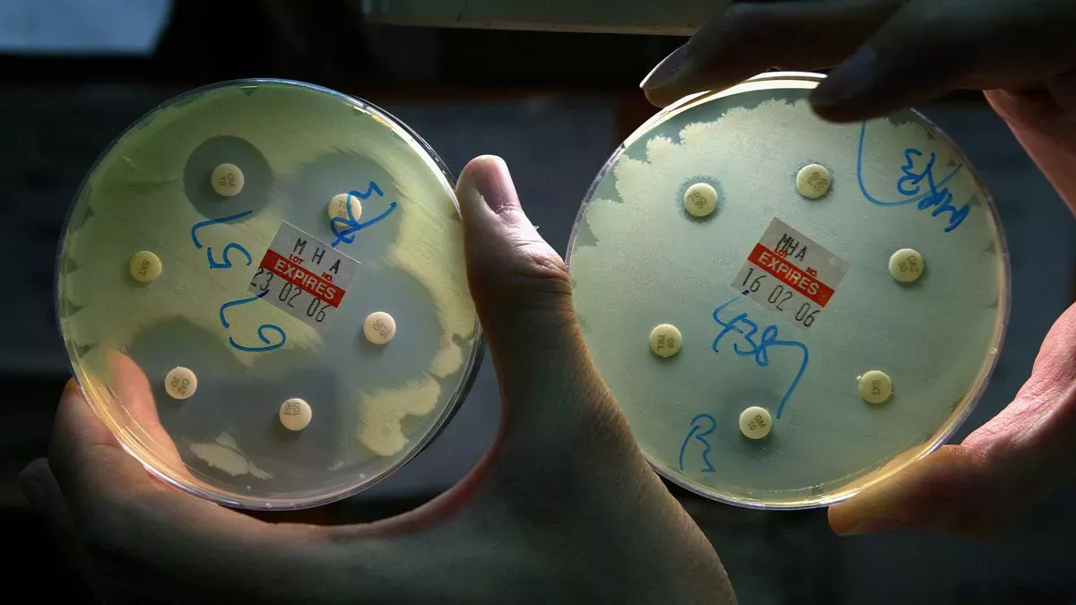 Las superbacterias van en aumento. C贸mo evitar que los antibi贸ticos queden obsoletos?