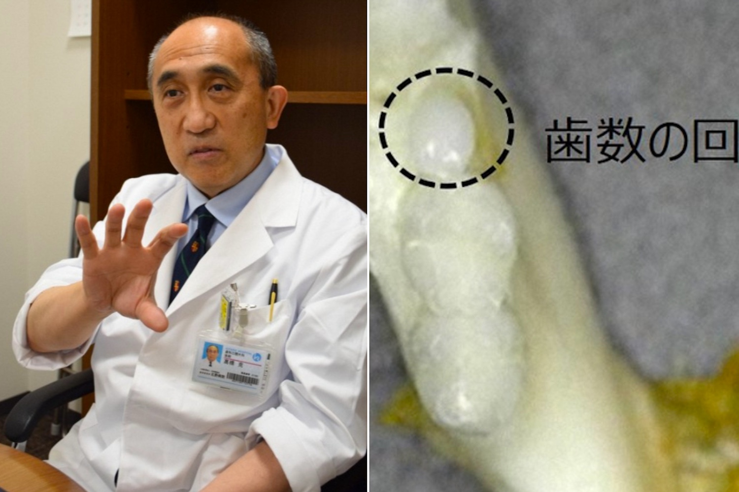 Un medicamento japonés que regenera los dientes podría acabar para siempre con las dentaduras postizas y los implantes