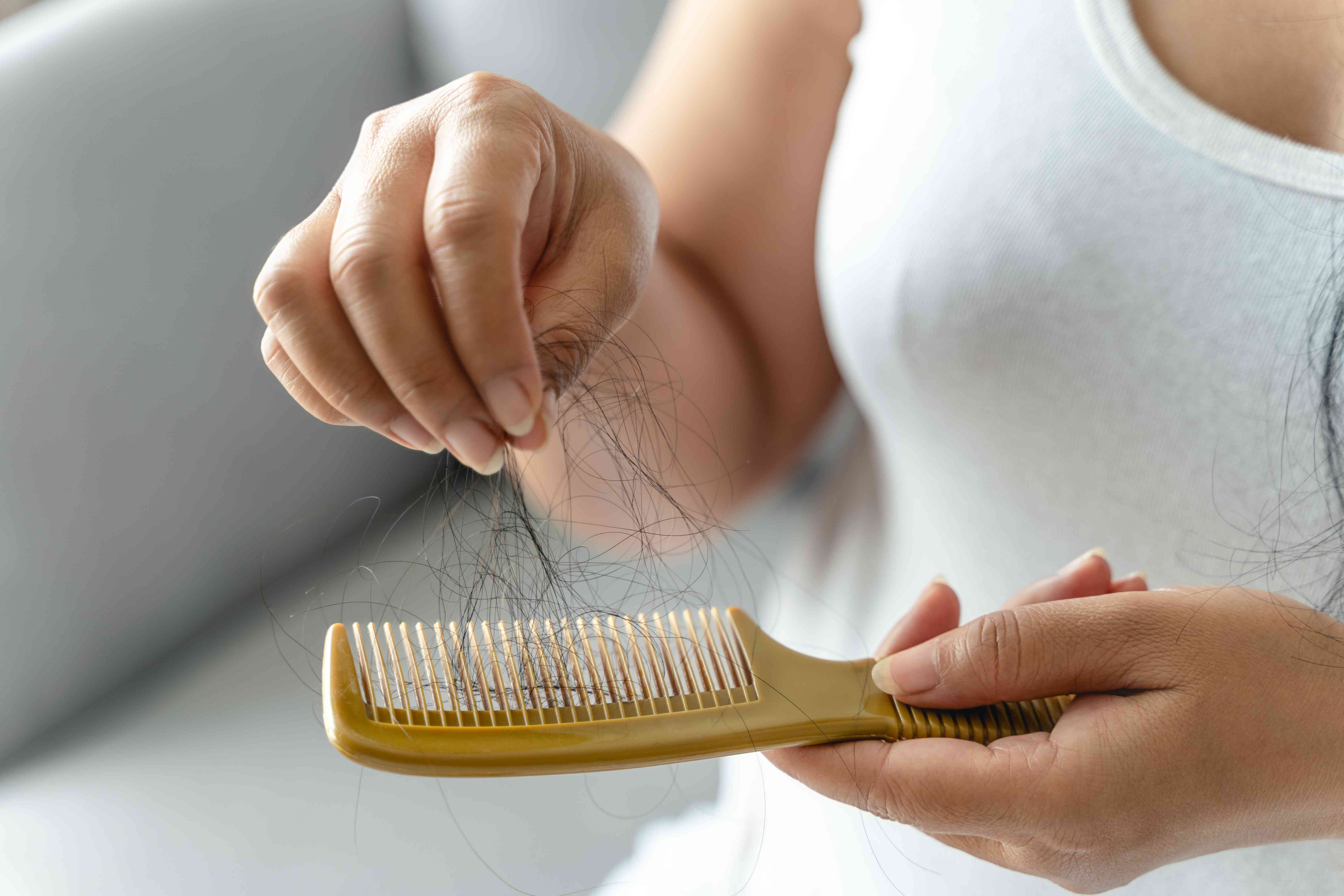 Un estudio ofrece más evidencia de que Ozempic podría causar pérdida de cabello