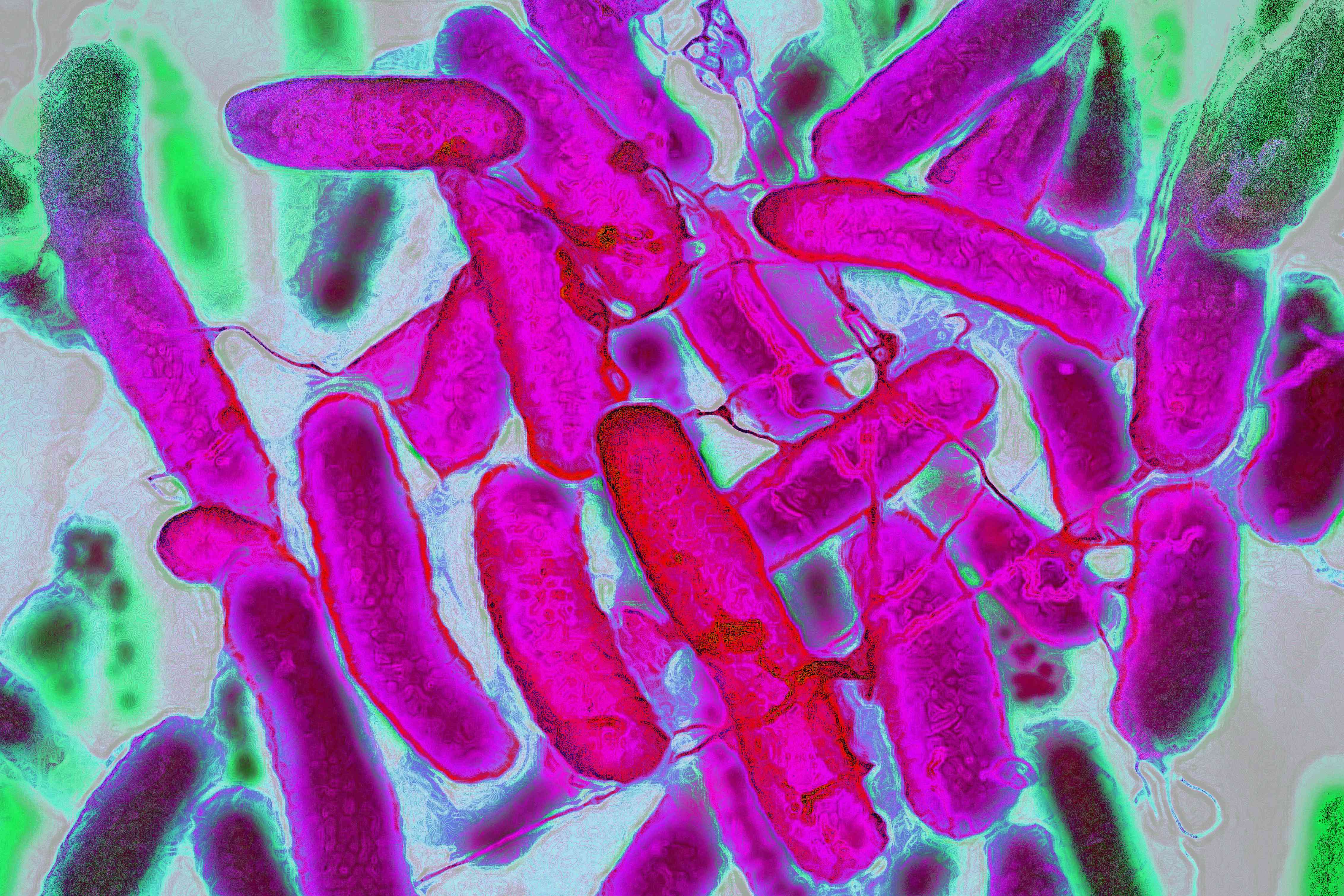 El Cáncer de Colon Aumenta en Personas Jóvenes—¿Es Una Toxina Bacteriana la Culpable?