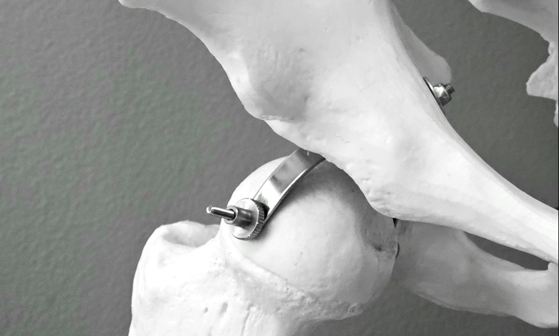 Salud de los huesos de la pelvis en un esqueleto