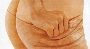  Combate la celulitis desde la alimentación