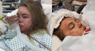 Comparte fotos de su hija después de consumir esta droga para crear conciencia