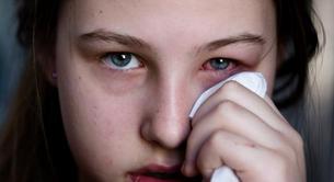 Los mejores consejos para curar la conjuntivitis